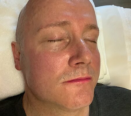 After treatment results for Mr Michael Grenville