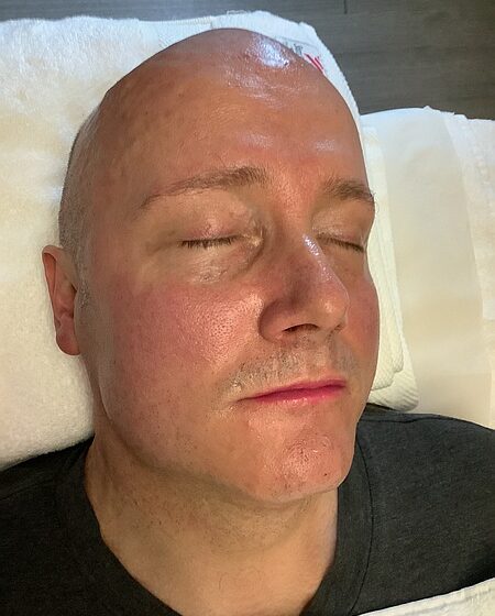 After treatment results for Mr Michael Grenville