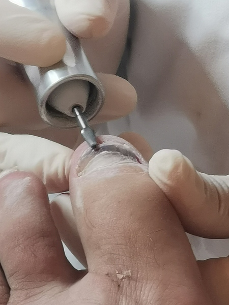 Margaret Dabbs Pedicure - Machine Filing