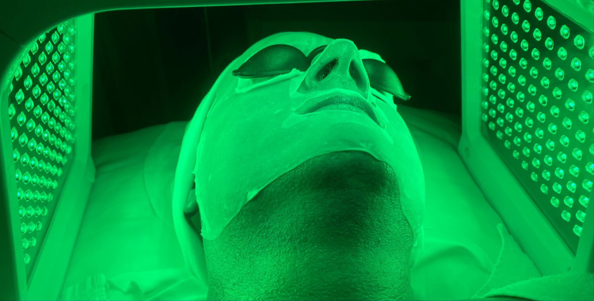 Linda Meredith Facial